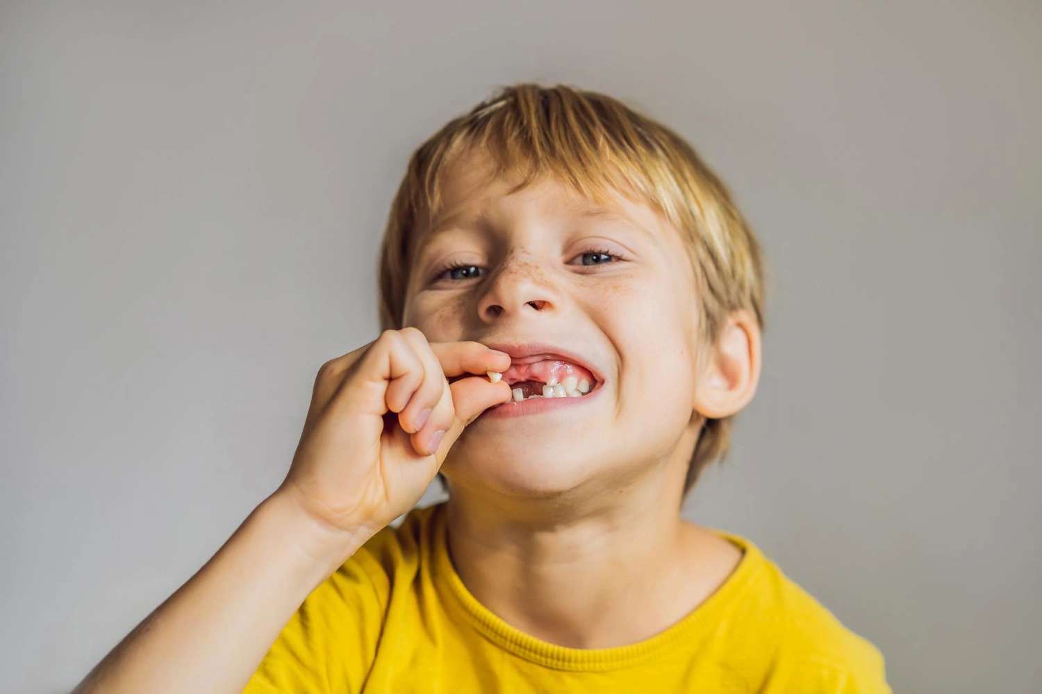 When Does a Child's Tooth Need to Be Removed