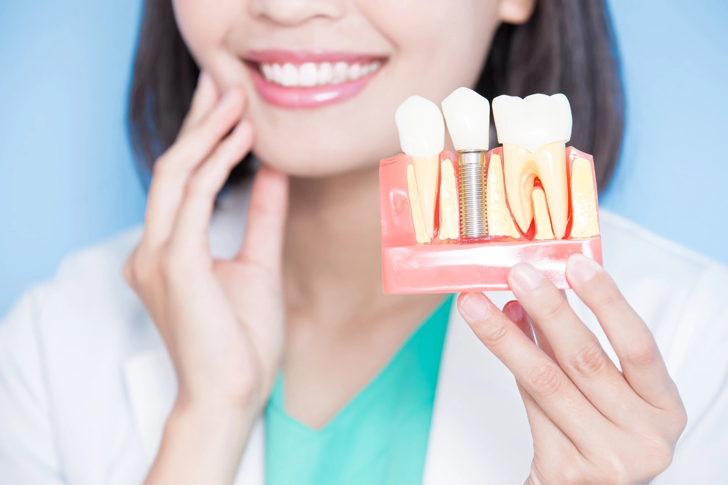 5 Ways Dental Implants Prevent Jawbone Loss and Preserve Your Smile - Image