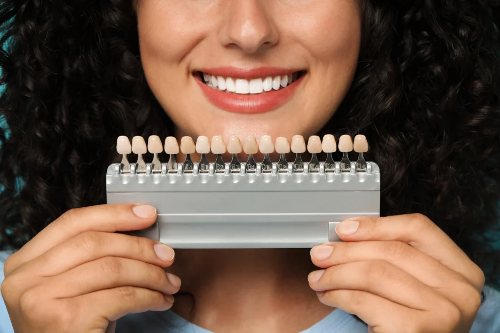 Are Veneers Permanent Insights from the Best Dentist in Devon - Image